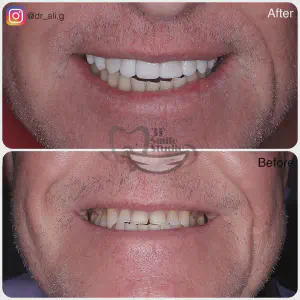 Smile Case