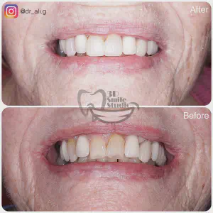 Smile Case