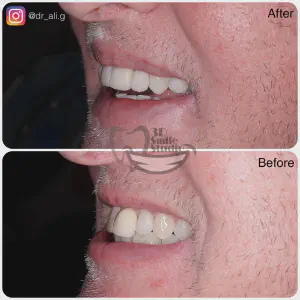 Smile Case