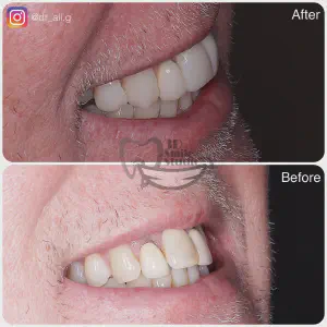 Smile Case