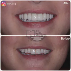 Smile Case