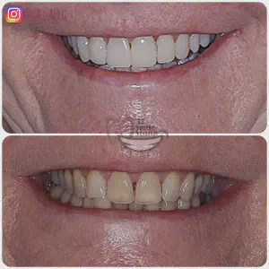 Smile Case