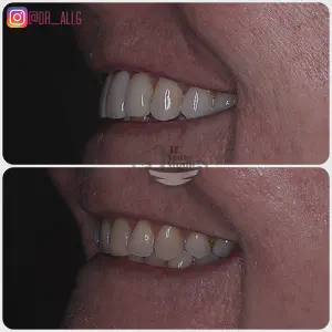 Smile Case