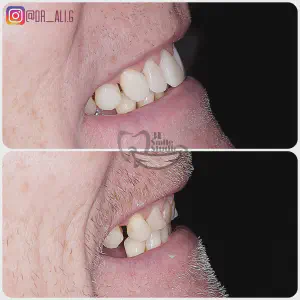 Smile Case