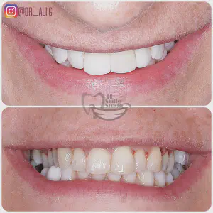 Smile Case