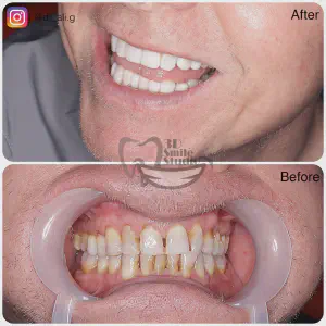Smile Case