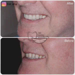 Smile Case