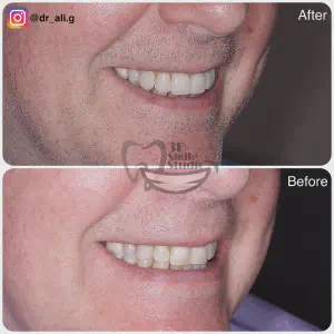 Smile Case