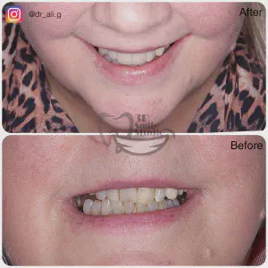 Smile Case